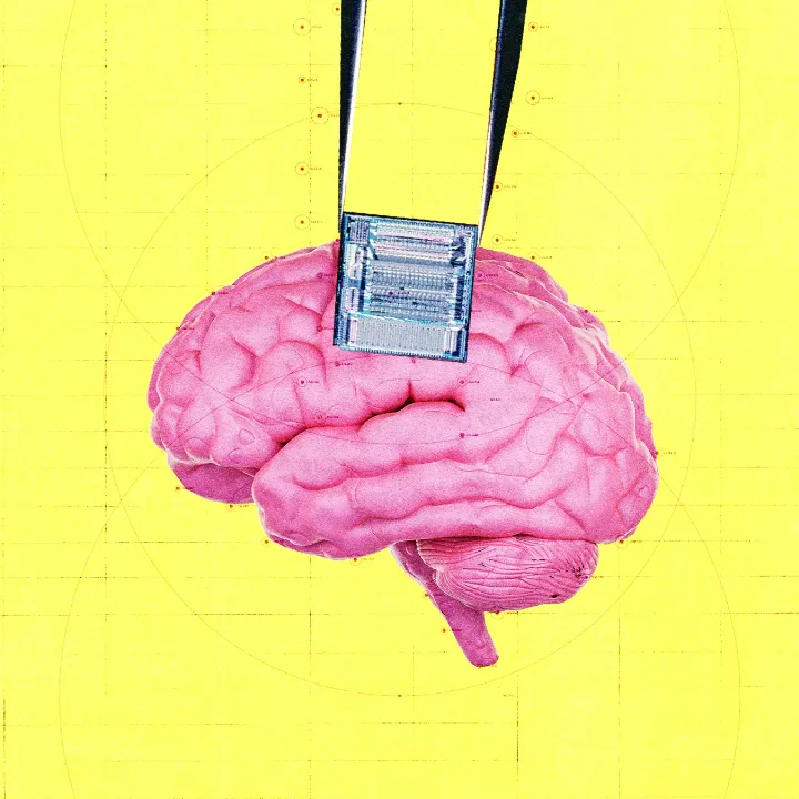 Image for: OpenAI Invests in Startup That Uses Brain Implants to Detect Cancer