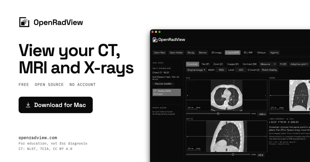 Preview of OpenRadView