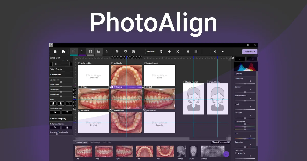 Preview of PhotoAlign